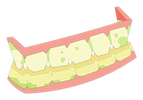 Dentier de Porkass